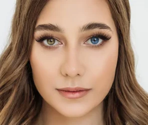 Heterochromia banner image