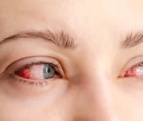 bloodshot eyes banner