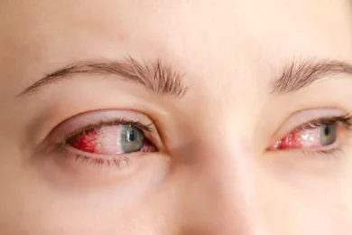 bloodshot eyes banner