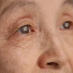 cataracts banner image