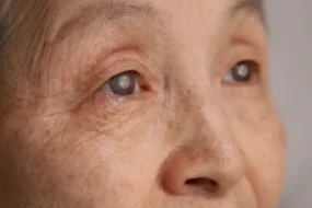 cataracts banner image