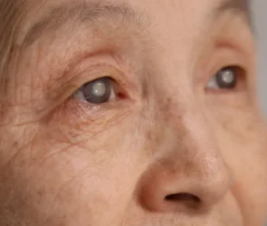 cataracts banner image