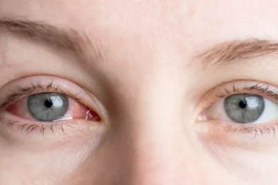 dry eyes banner image