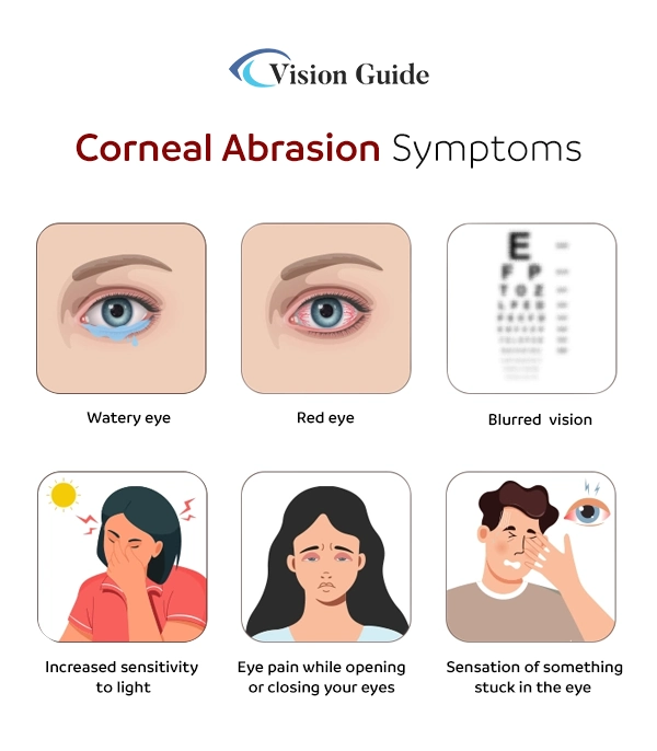 Corneal Abrasion Symptoms