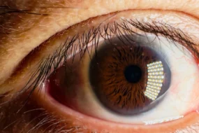 Diabetic Retinopathy