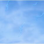 eye floaters in vision