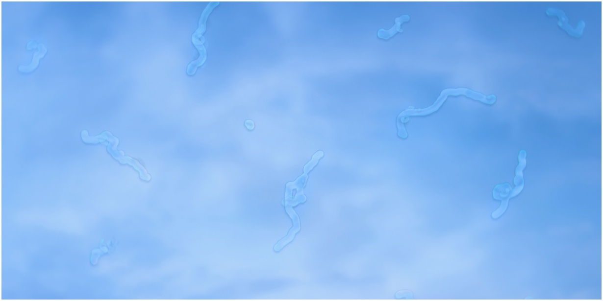 eye floaters in vision