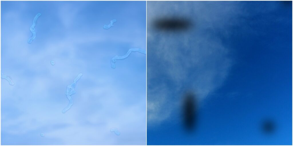 types of eye floaters